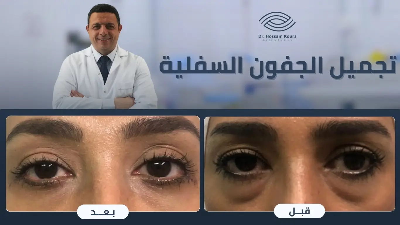 أفضل دكتور تجميل جفون في مصر