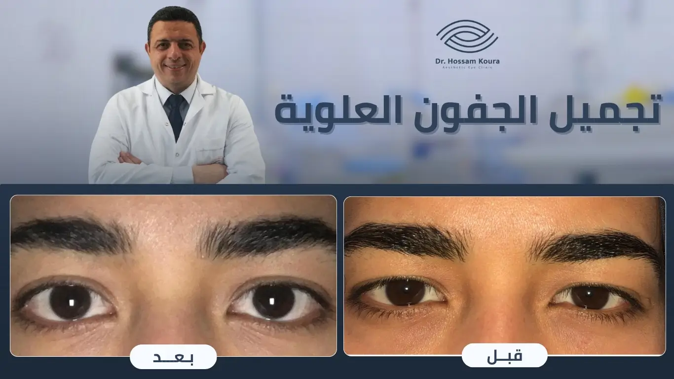 أفضل دكتور تجميل جفون في مصر
