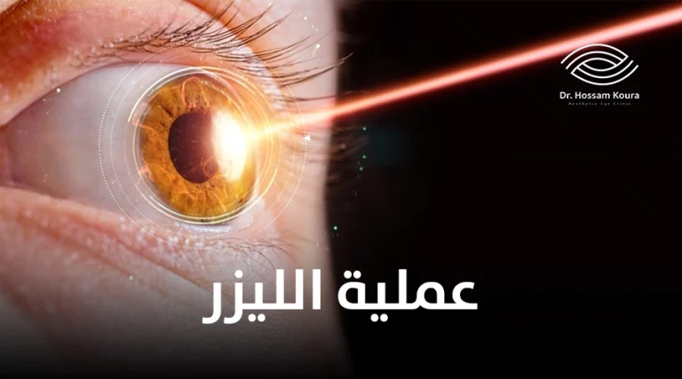عملية الليزر