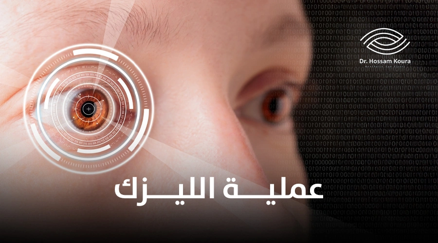 عملية الليزك