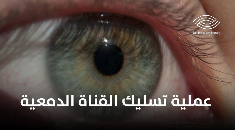 عملية تسليك القناة الدمعية