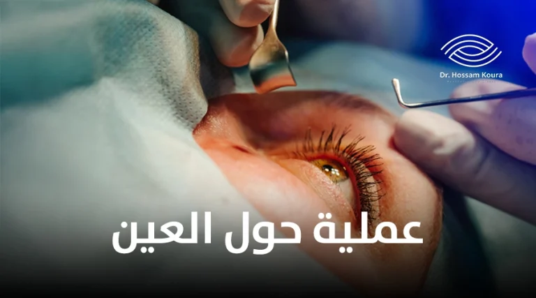 عملية حول العين