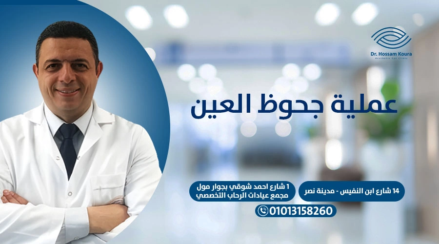 عملية جحوظ العين