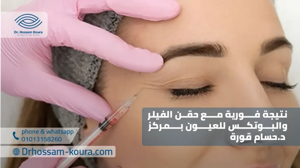 نتيجة فورية مع حقن الفيلر والبوتكس للعيون بمركز د.حسام قورة